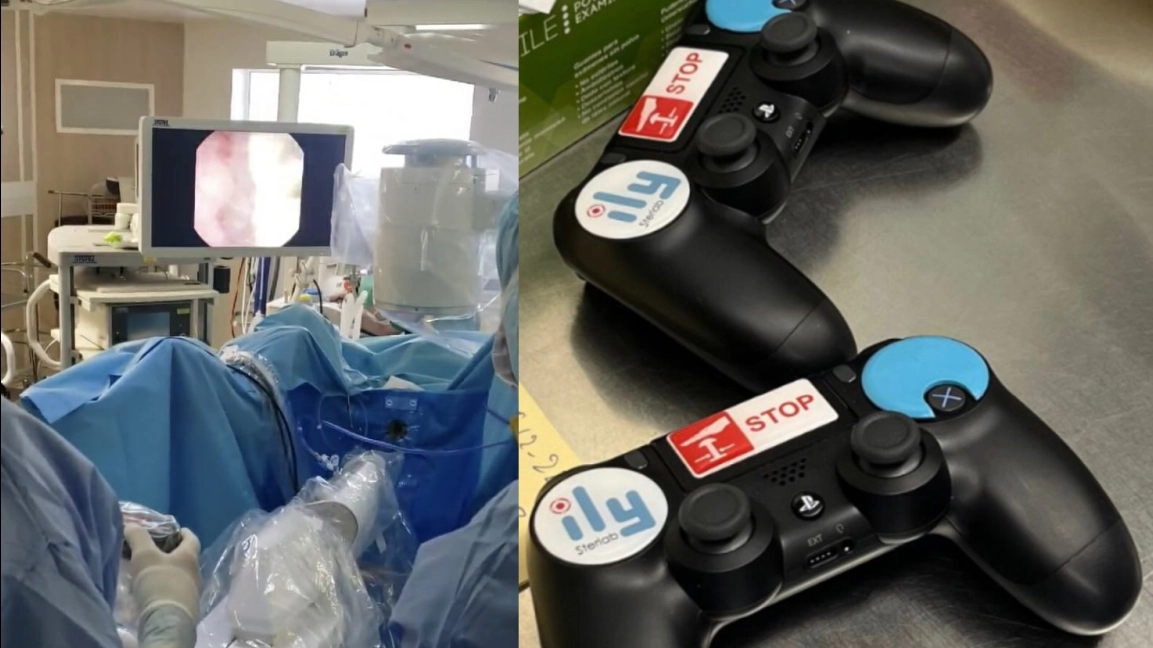 PlayStation in sala operatoria: eseguito un intervento con DualShock e robot Ily