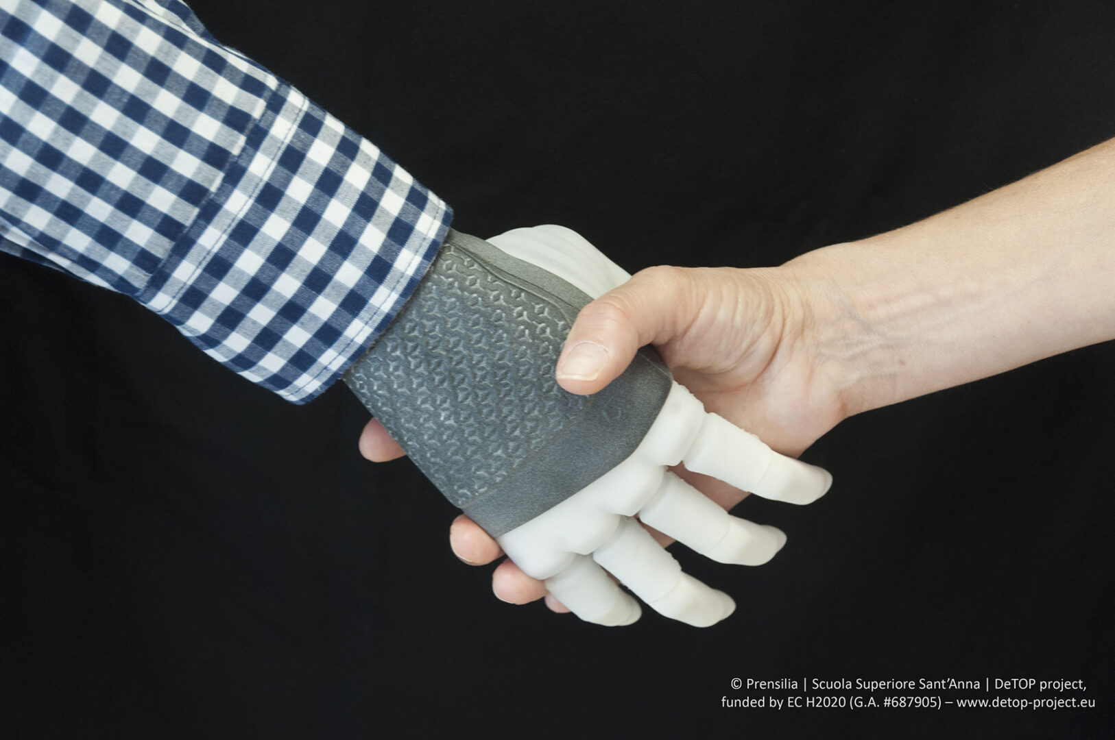 La prima protesi bionica connessa a scheletro e nervi: una grande svolta nella tecnologia medica